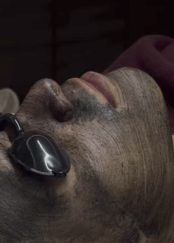 Foto del servicio Paquete Láser Hollywood Peel X 4