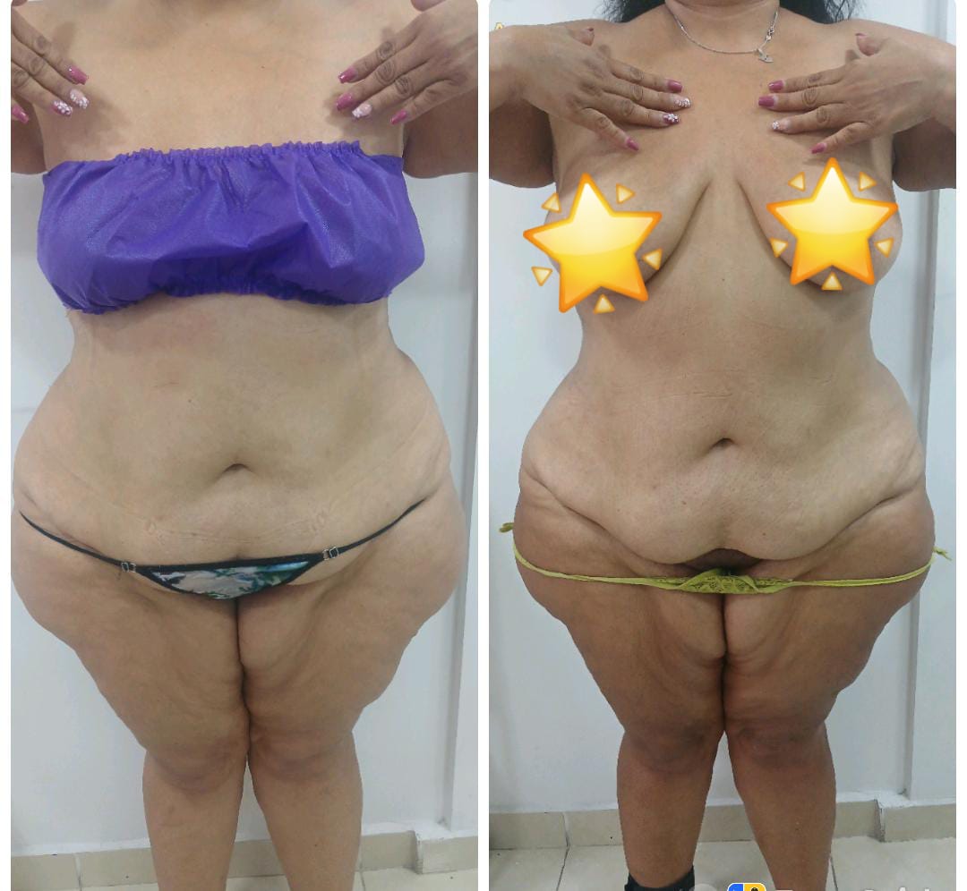 Foto del servicio Tratamiento reductor