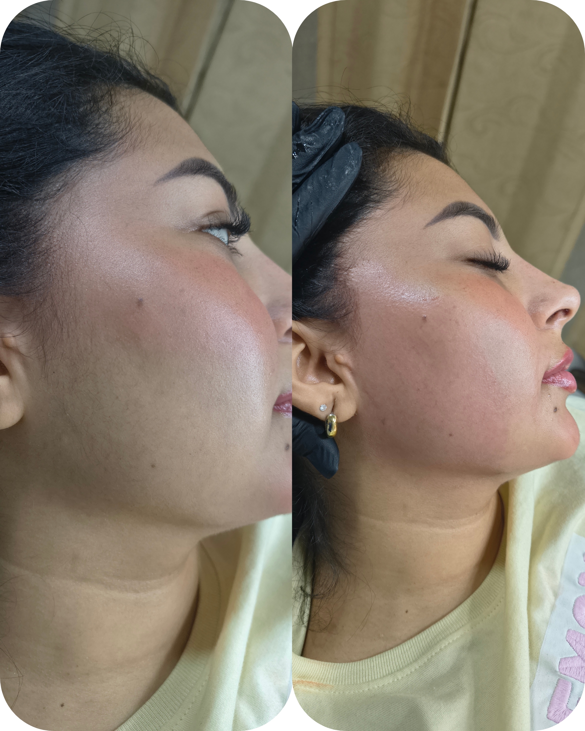 Foto del servicio LG|Epilacion full facial
