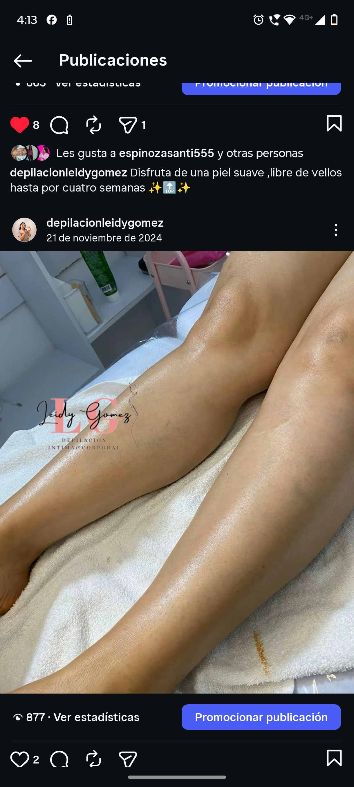 Foto del servicio Epilación Media Pierna