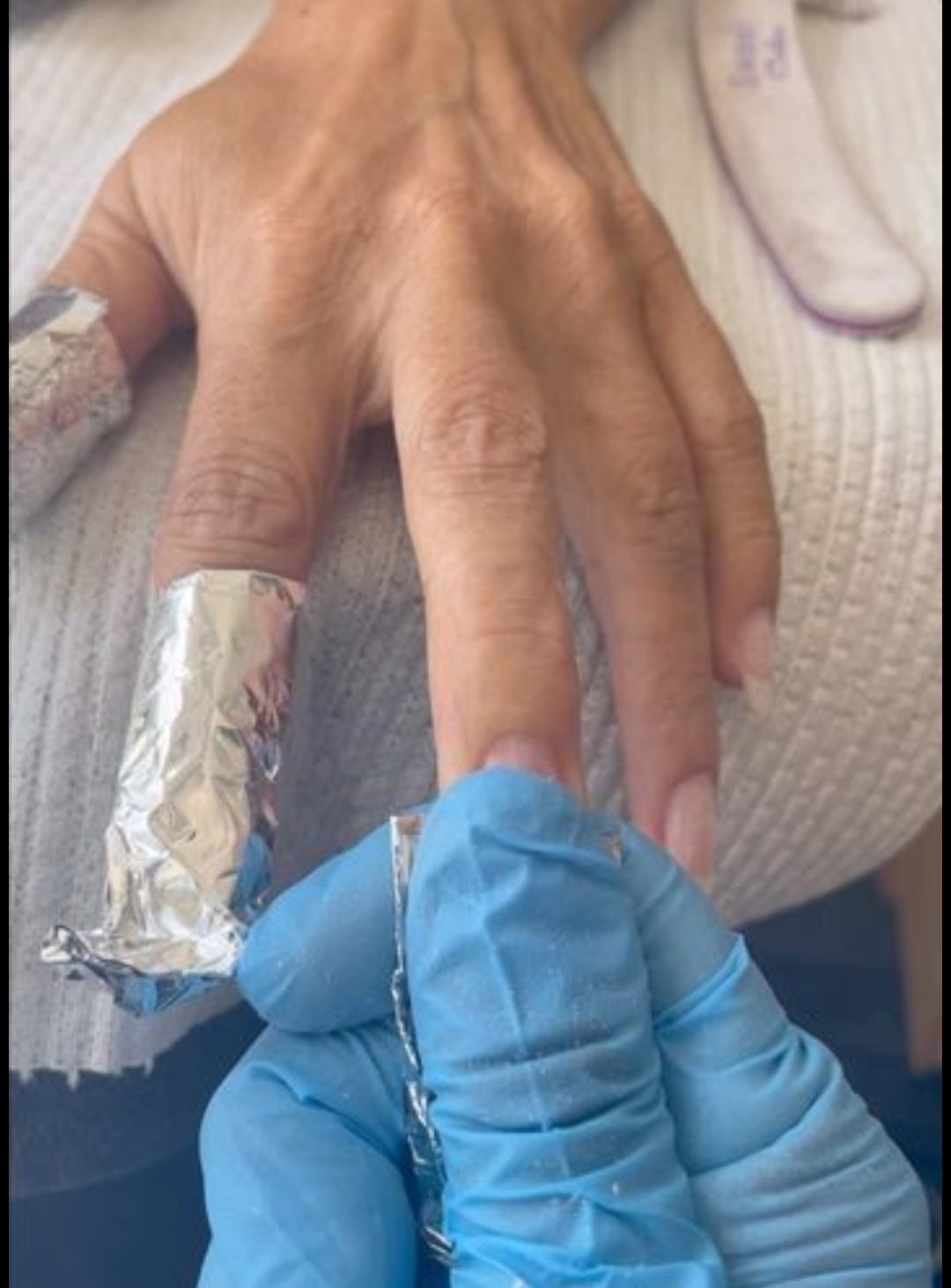 Foto del servicio Retiro acrílico