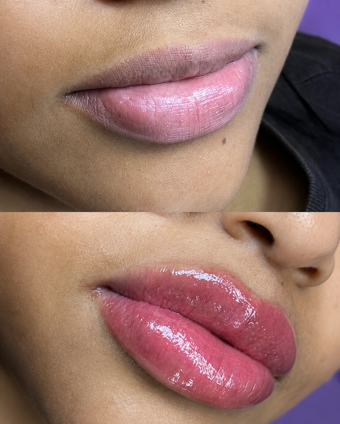 Foto del servicio Micropigmentacion de labios
