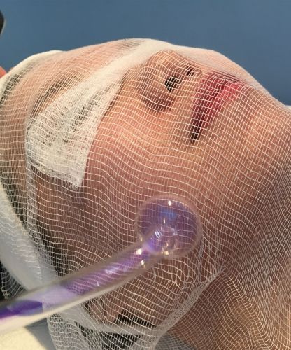 Foto del servicio Limpieza facial profunda