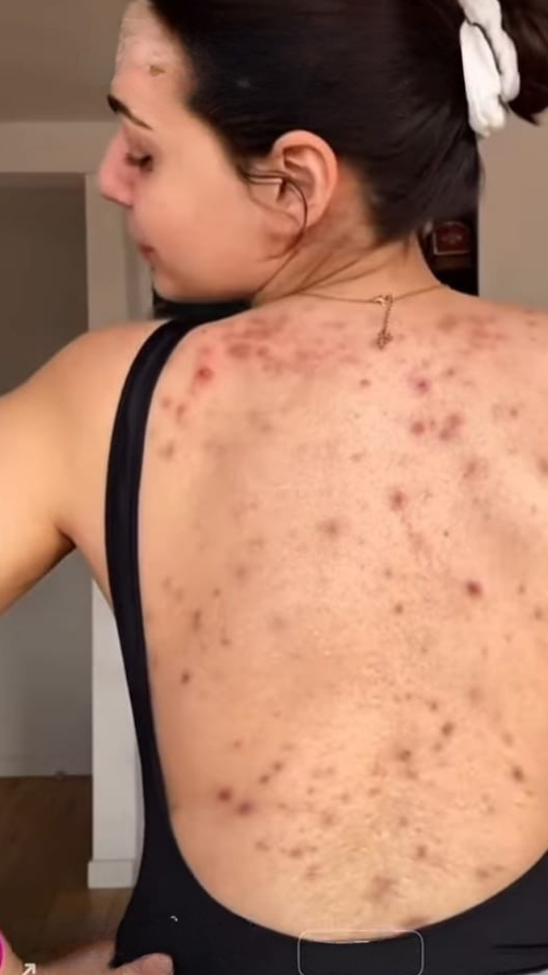 Foto del servicio Back Cleaning