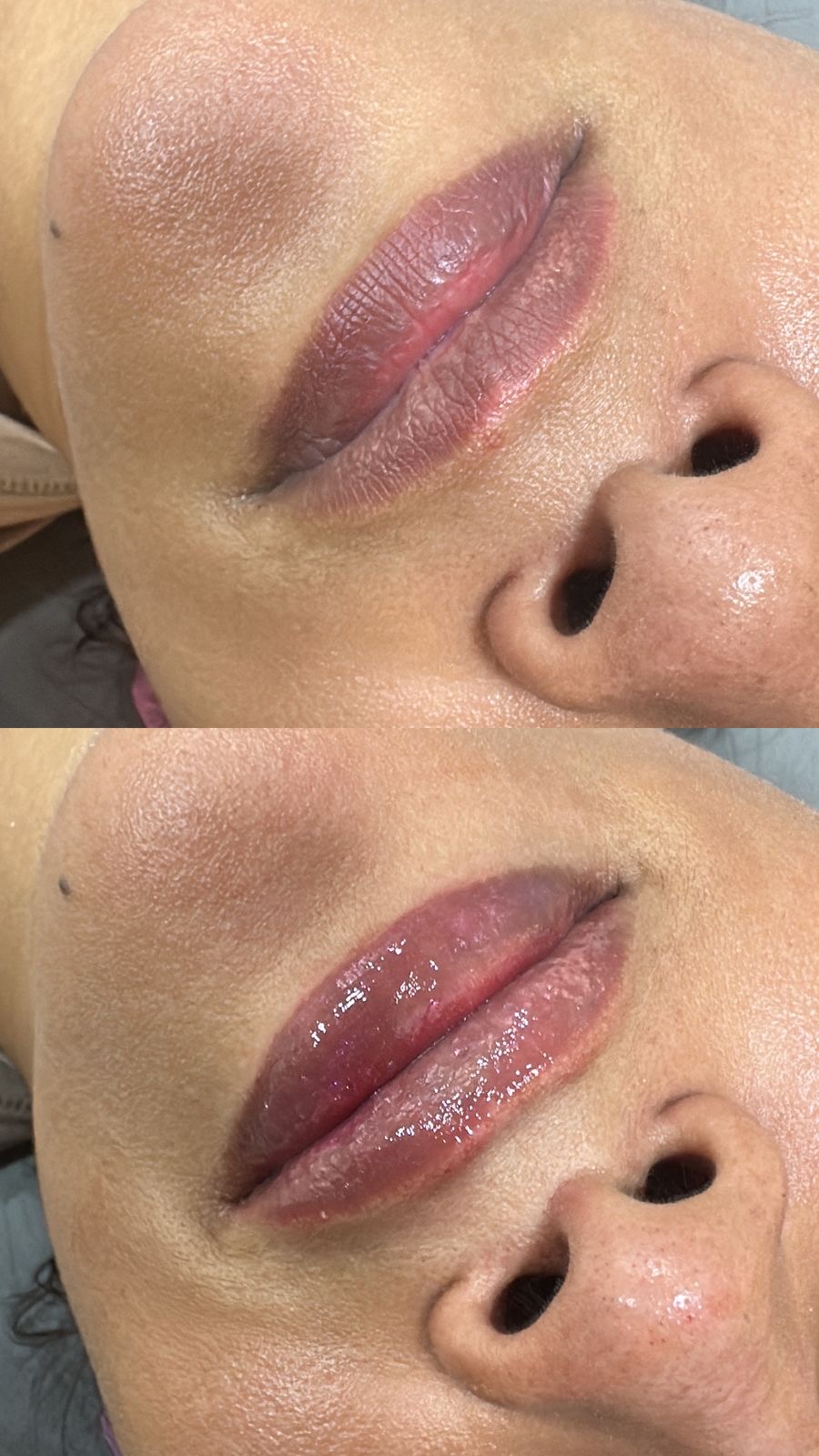 Foto del servicio Labios con A.H