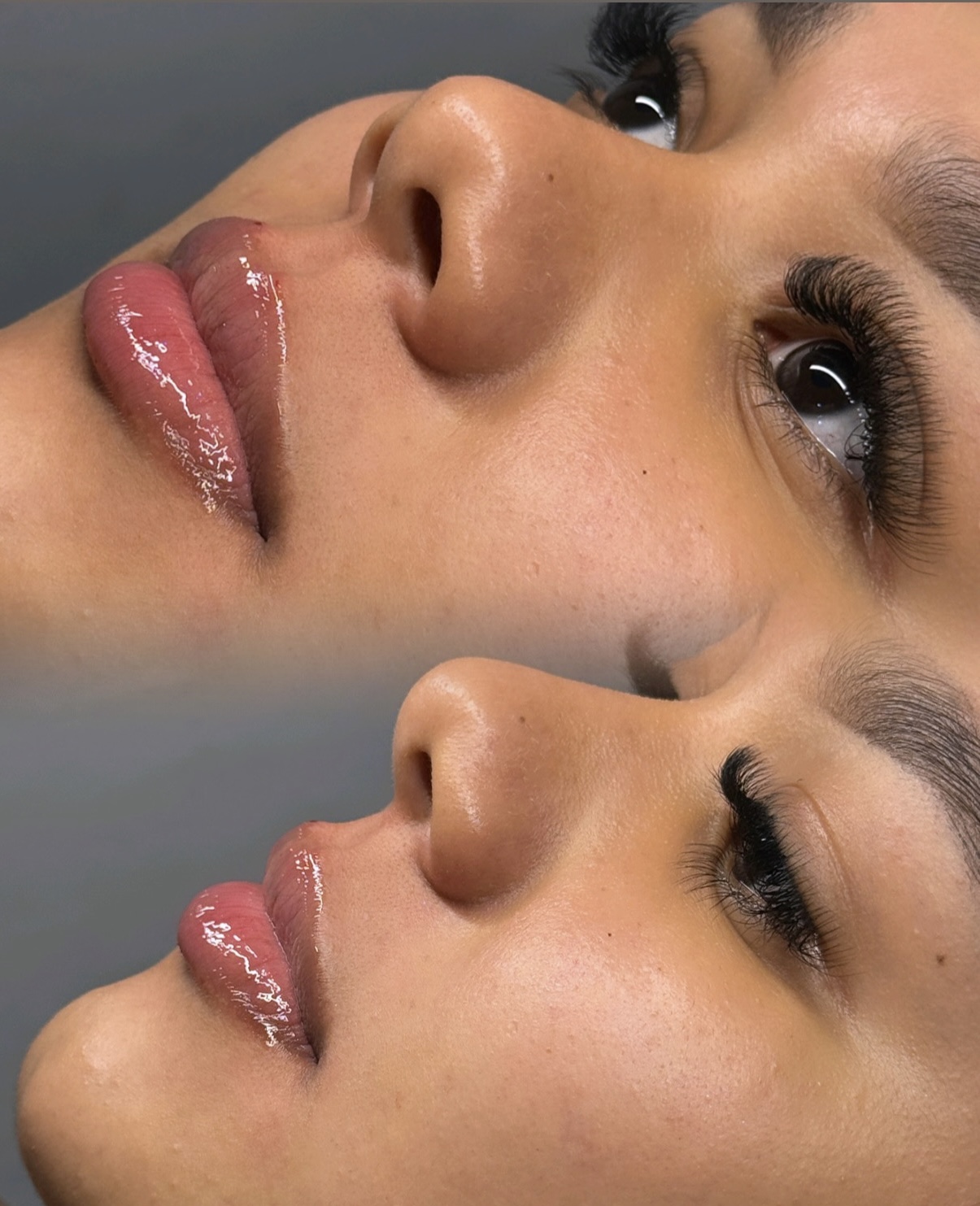 Foto del servicio Labios con A.H