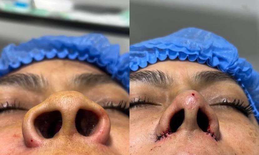 Foto del servicio Aletomia