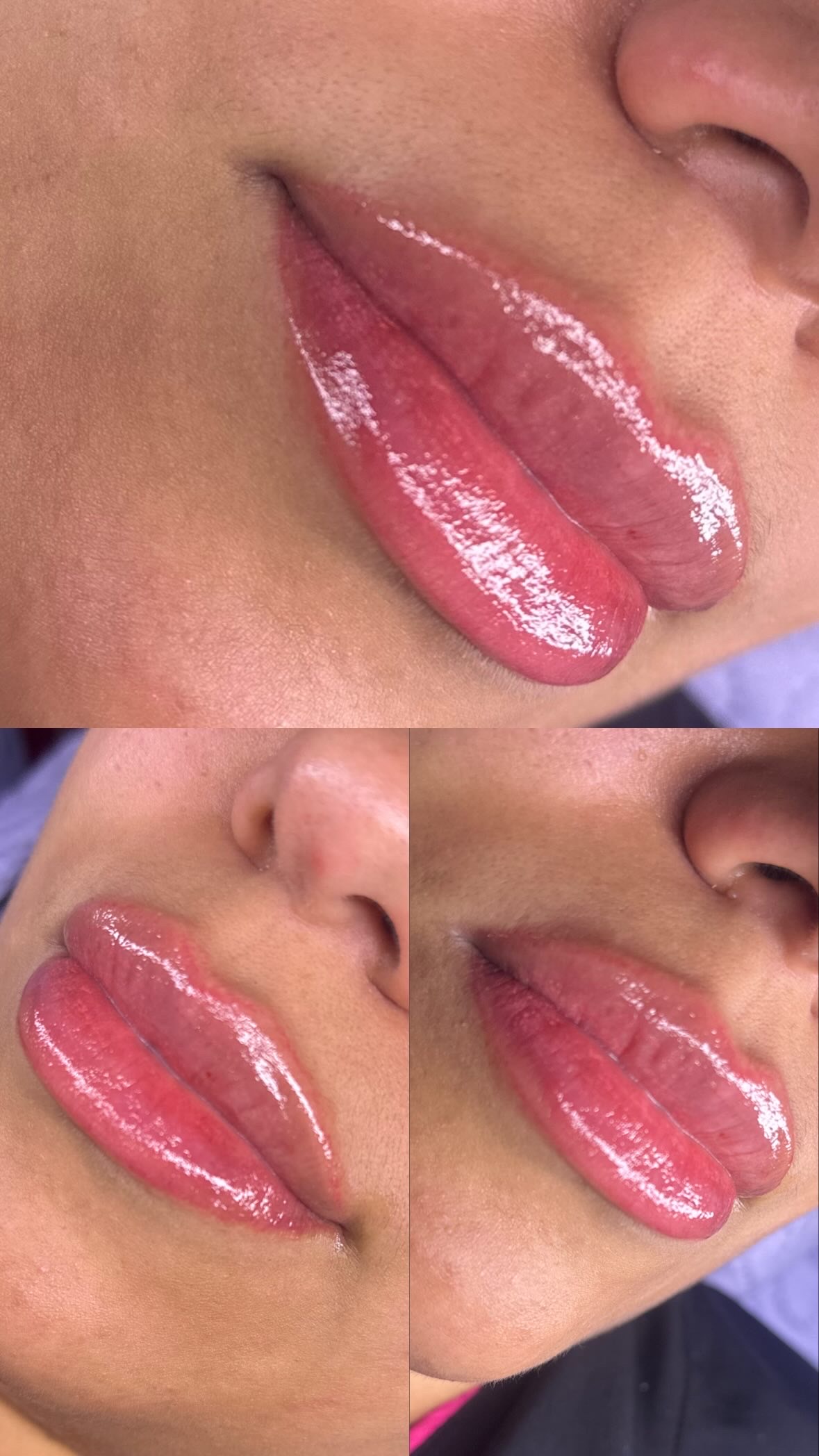 Foto del servicio Micropigmentacion labial