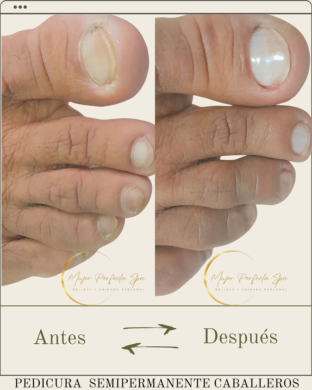 Foto del servicio Pedicura Semipermanente