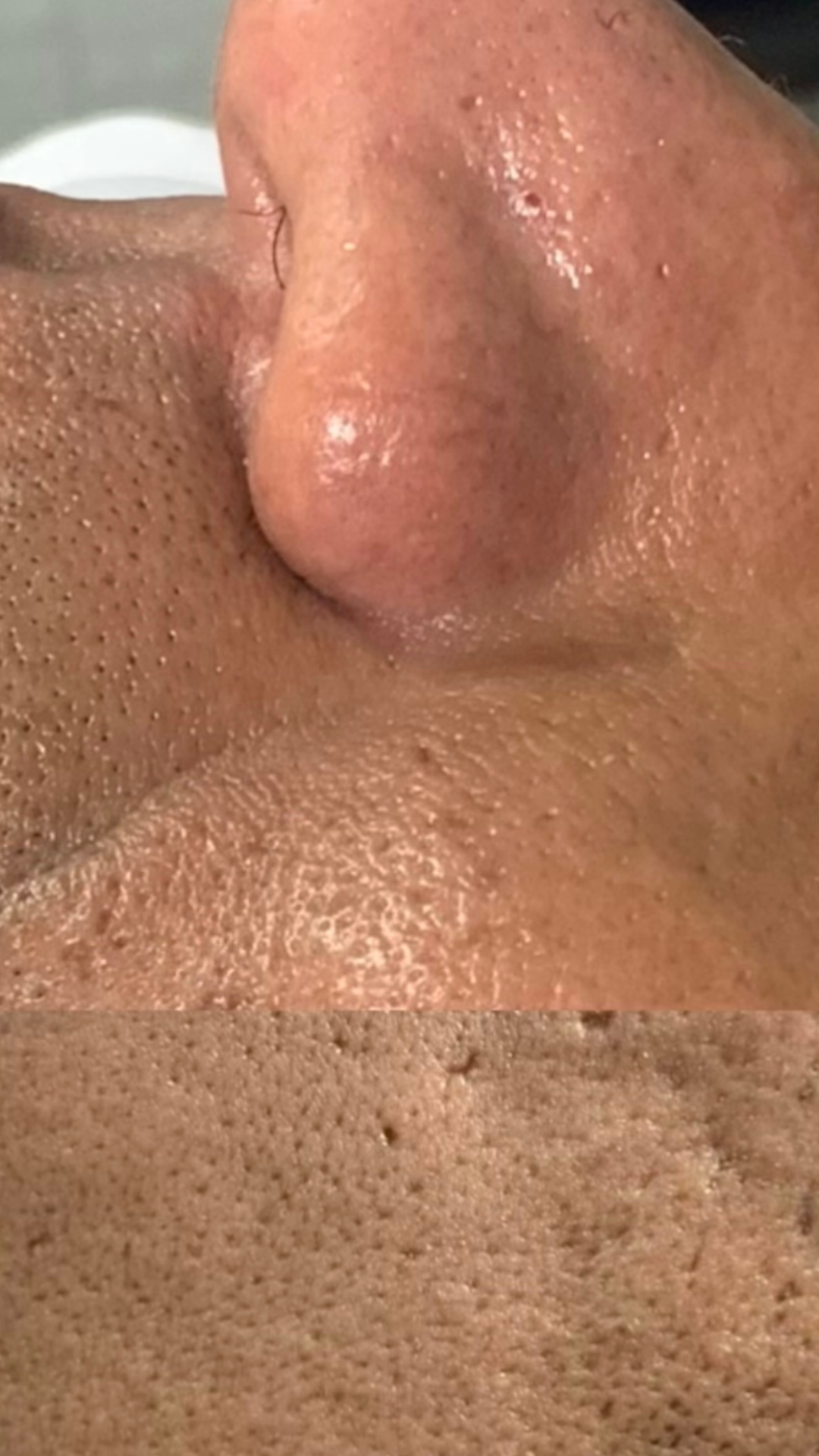 Foto del servicio Oxigenación Facial