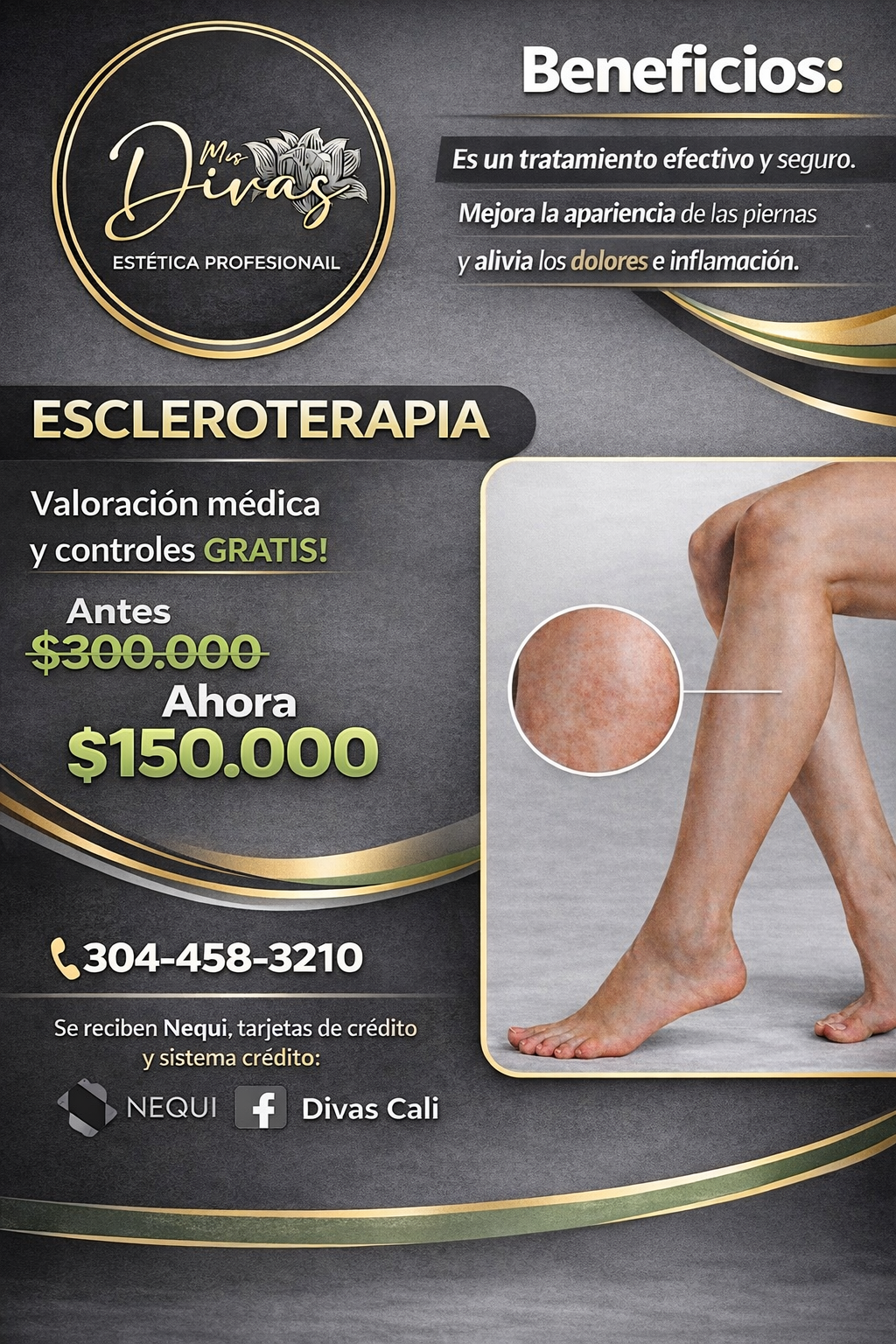 Foto del servicio Escleroterapia en piernas