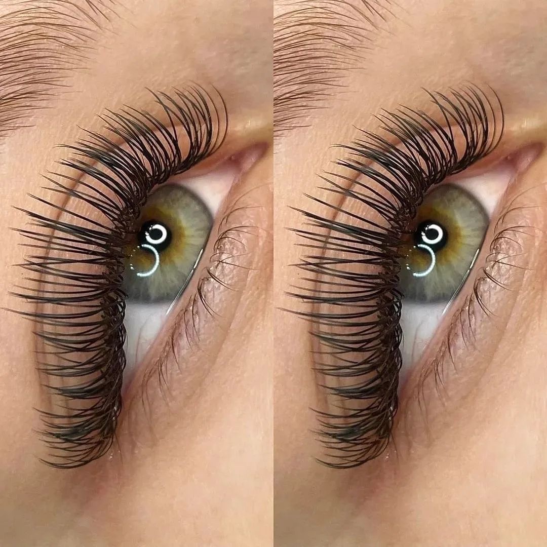 Foto del servicio 29. Set Aura 2DU