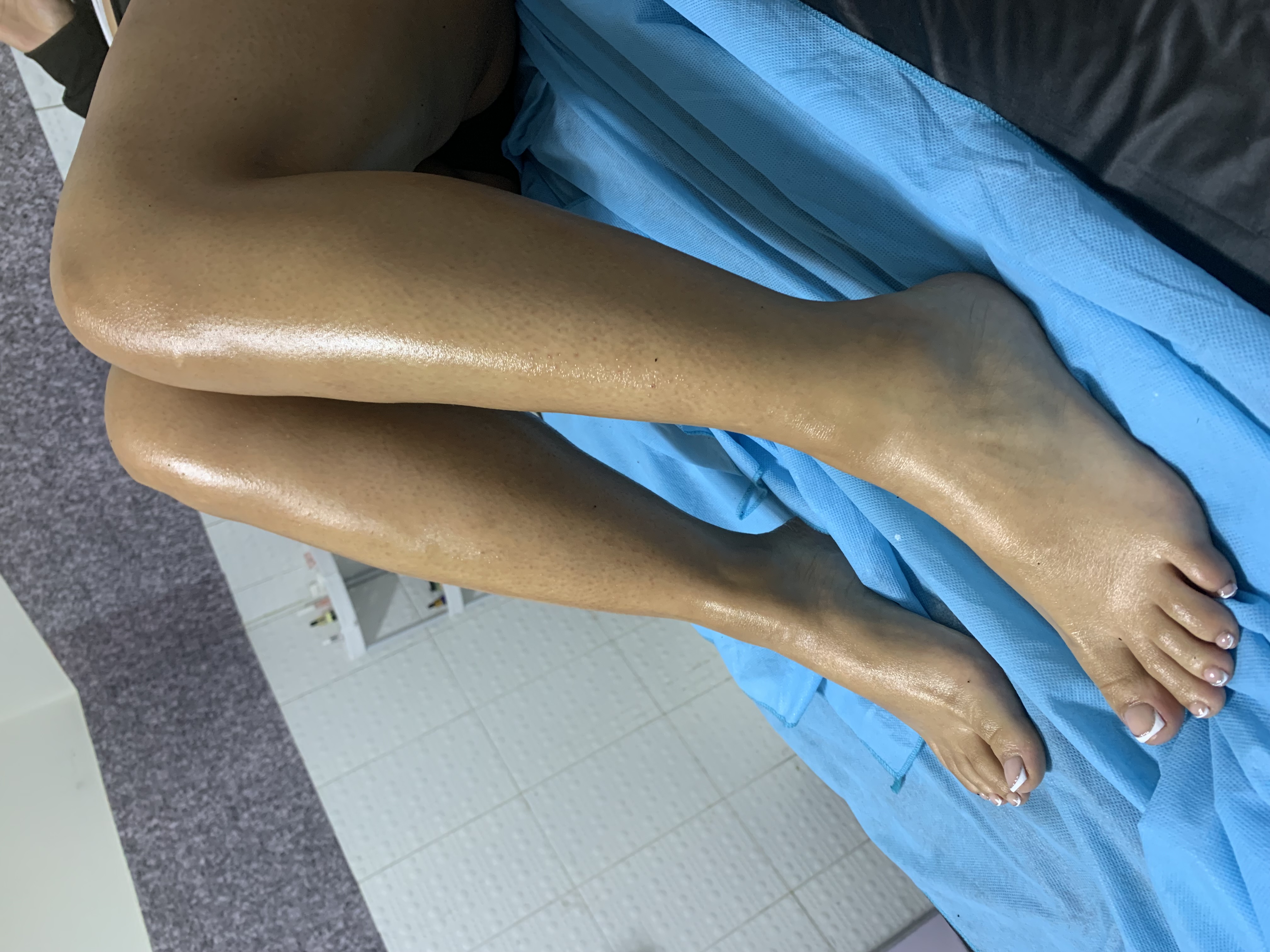 Foto del servicio Depilación de Piernas