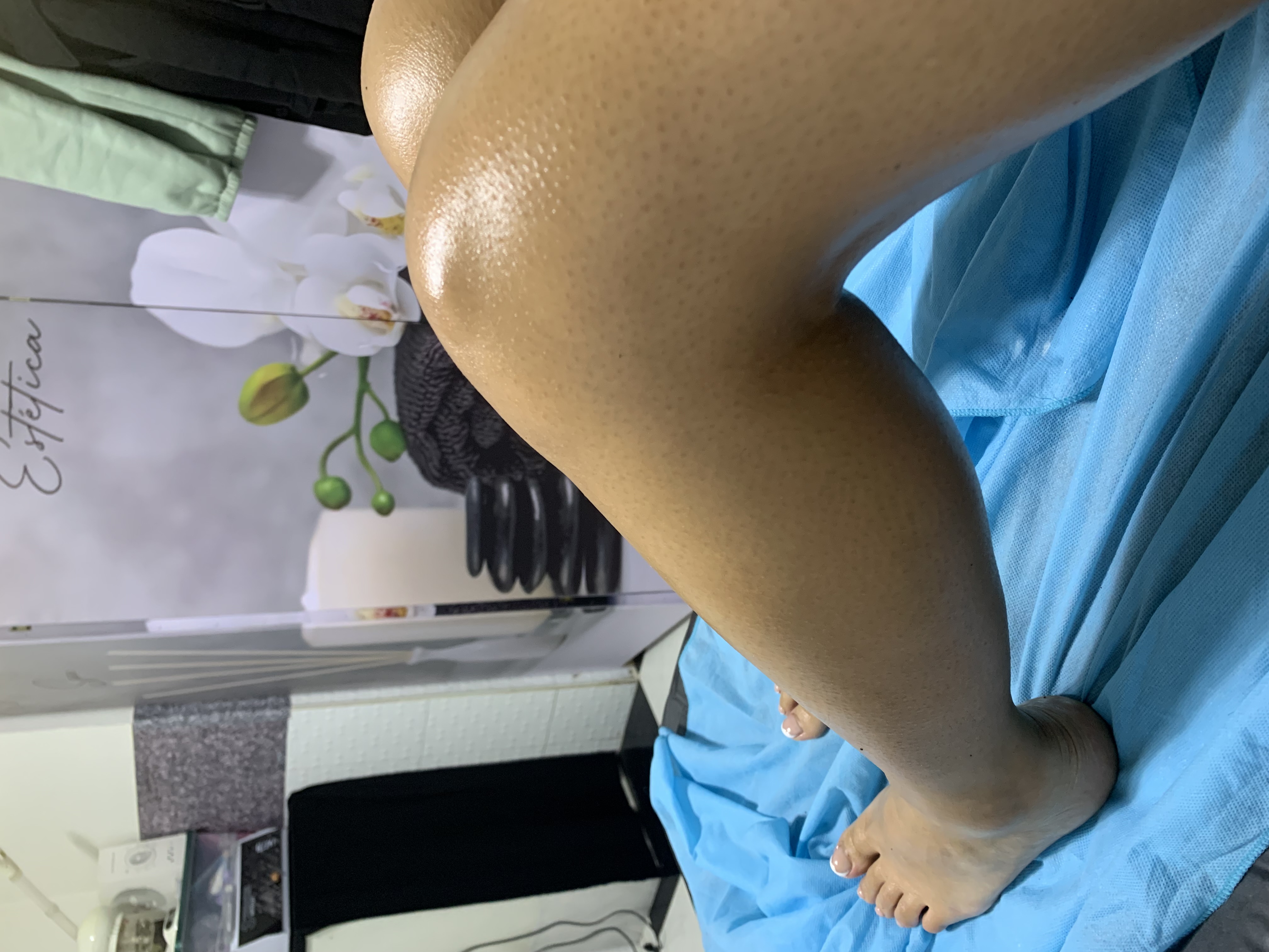 Foto del servicio Depilación de Piernas