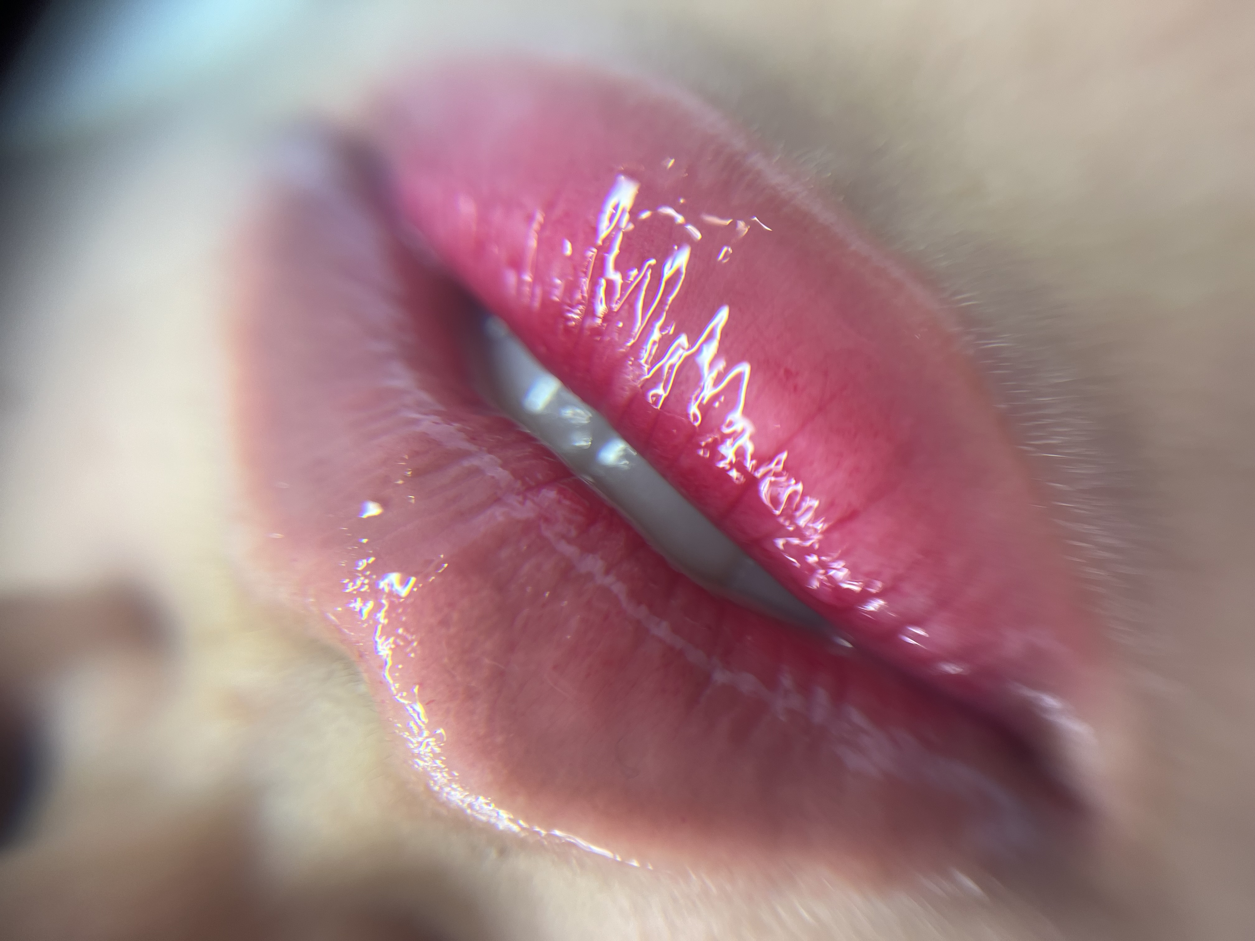 Foto del servicio Hidragloss lips