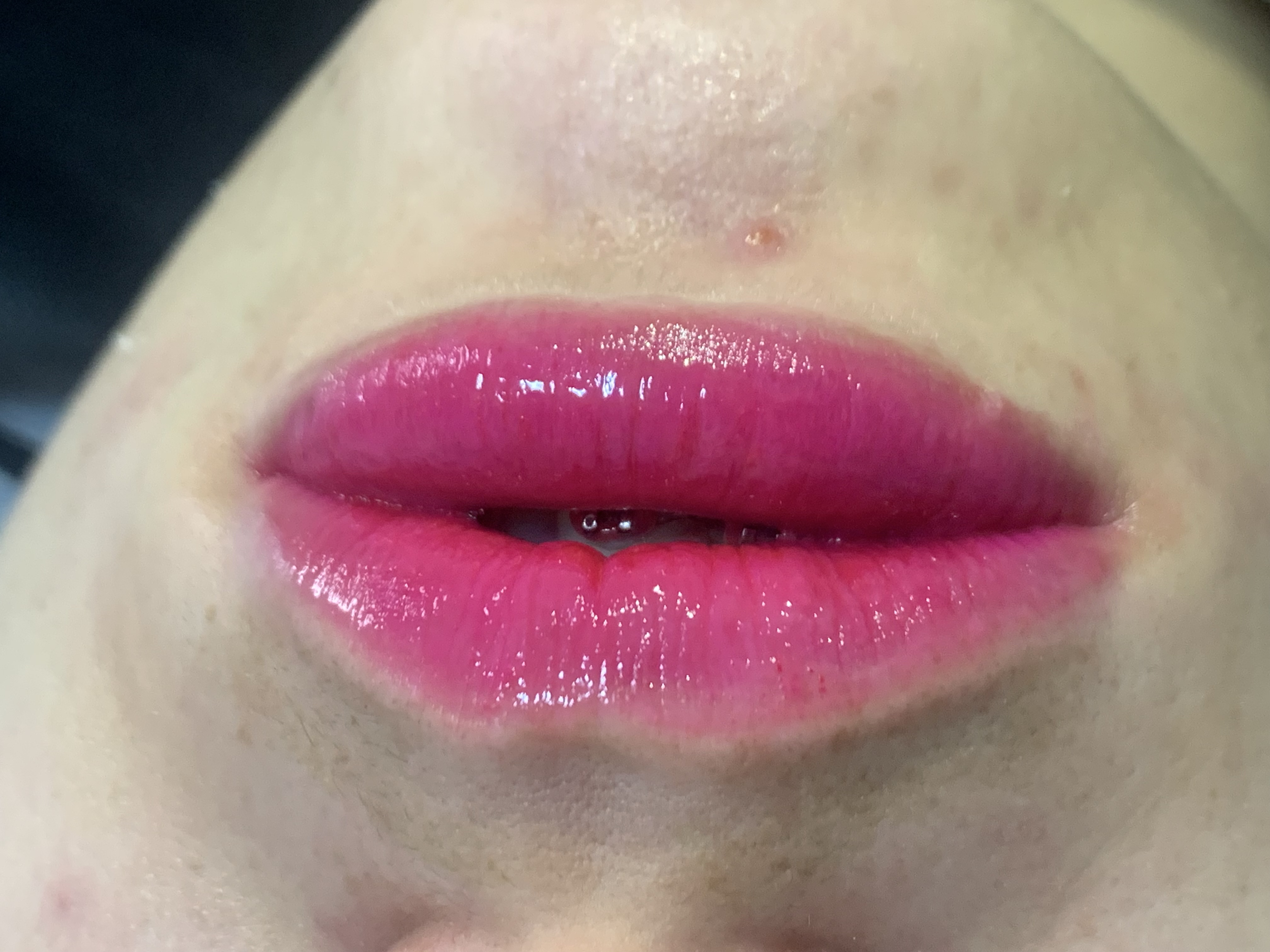 Foto del servicio BB Lips