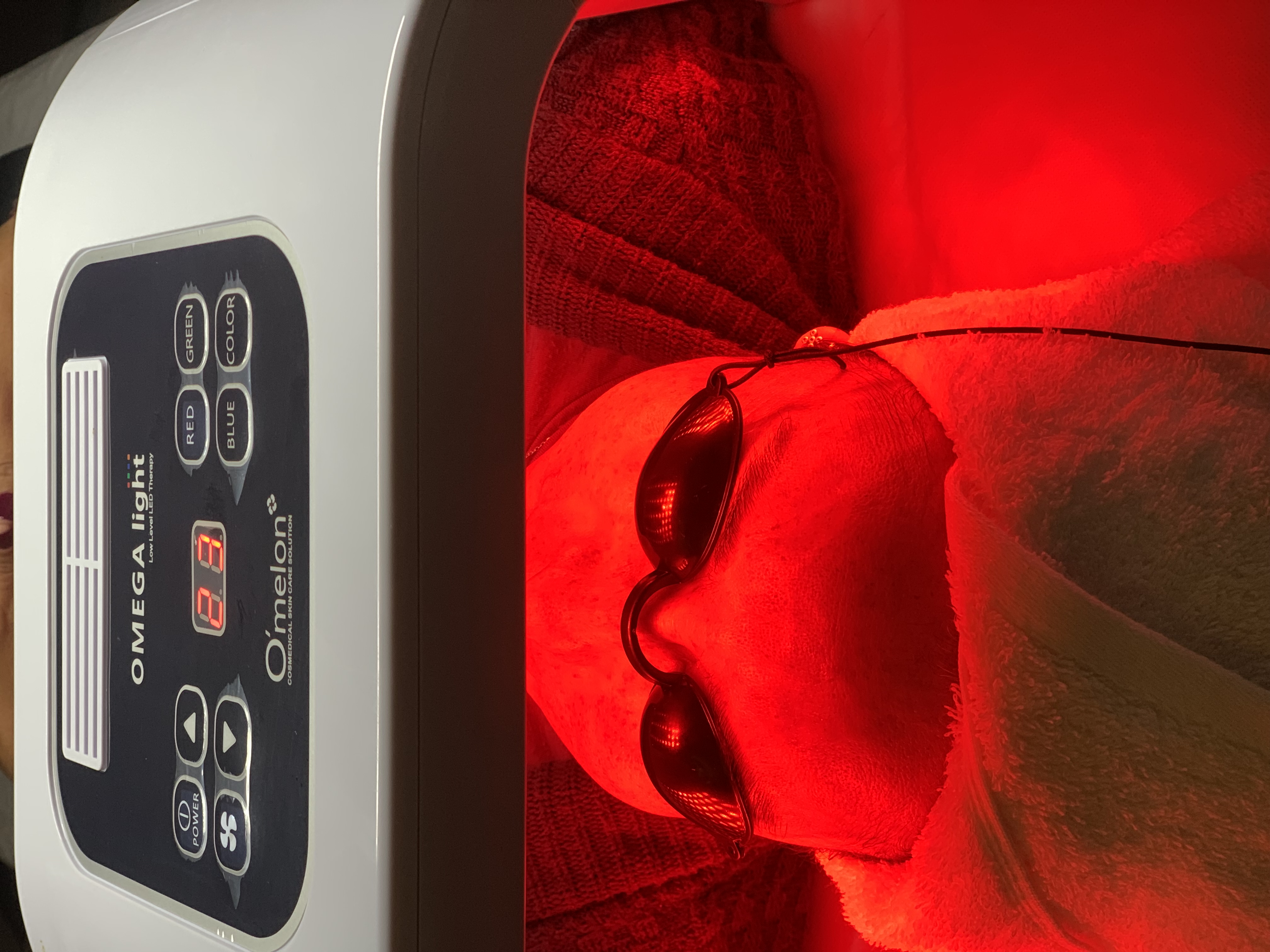 Foto del servicio MICRONEEDLING PRO