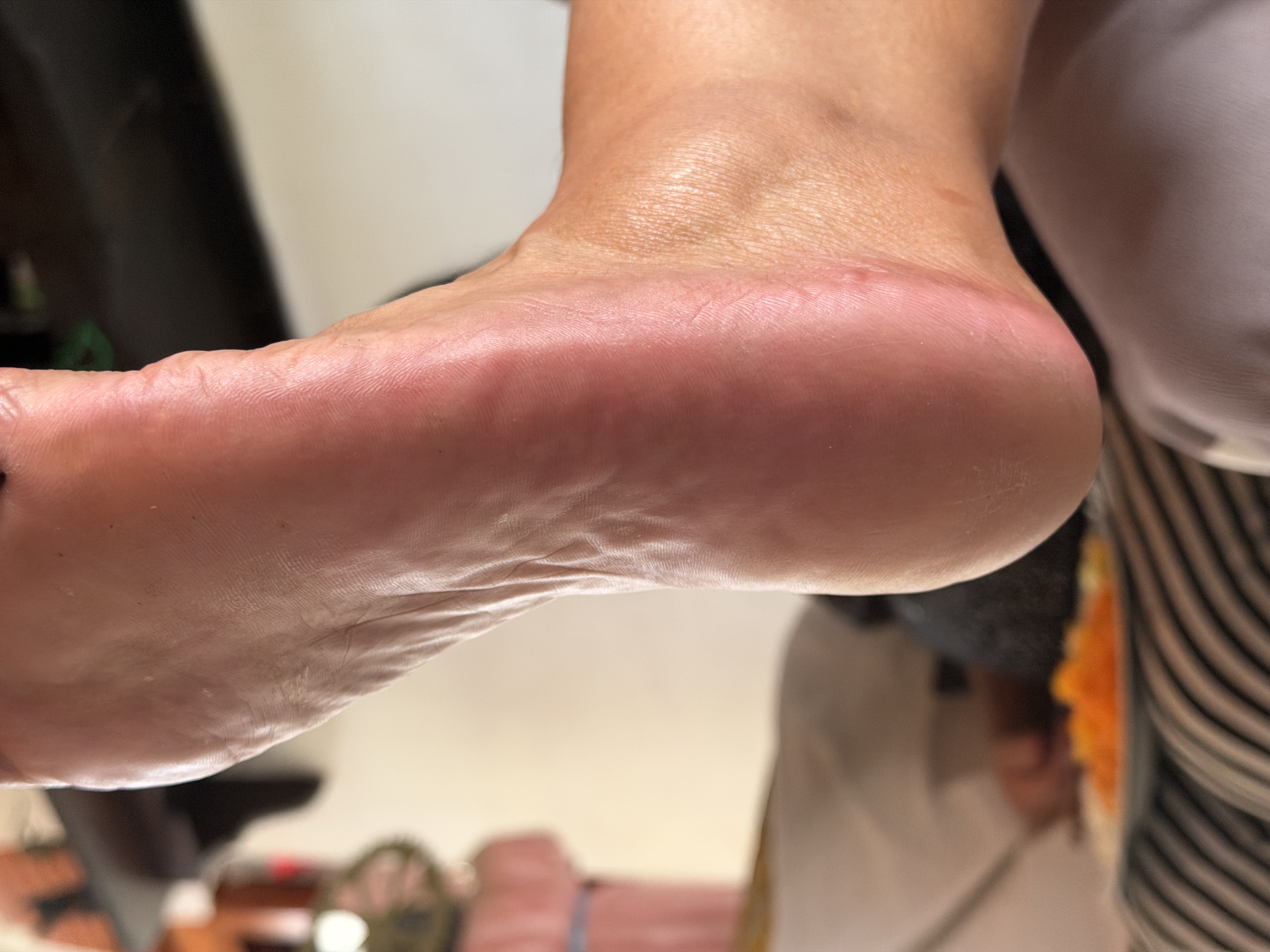 Foto del servicio Terapia plantar