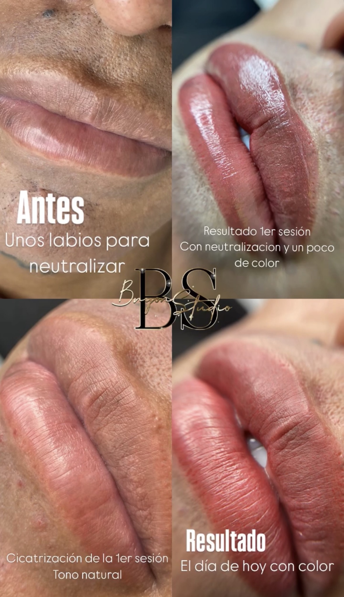 Foto del servicio Micropigmentacion de labios