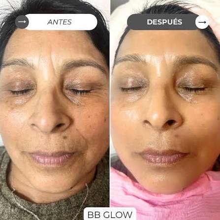 Foto del servicio BB GLOW