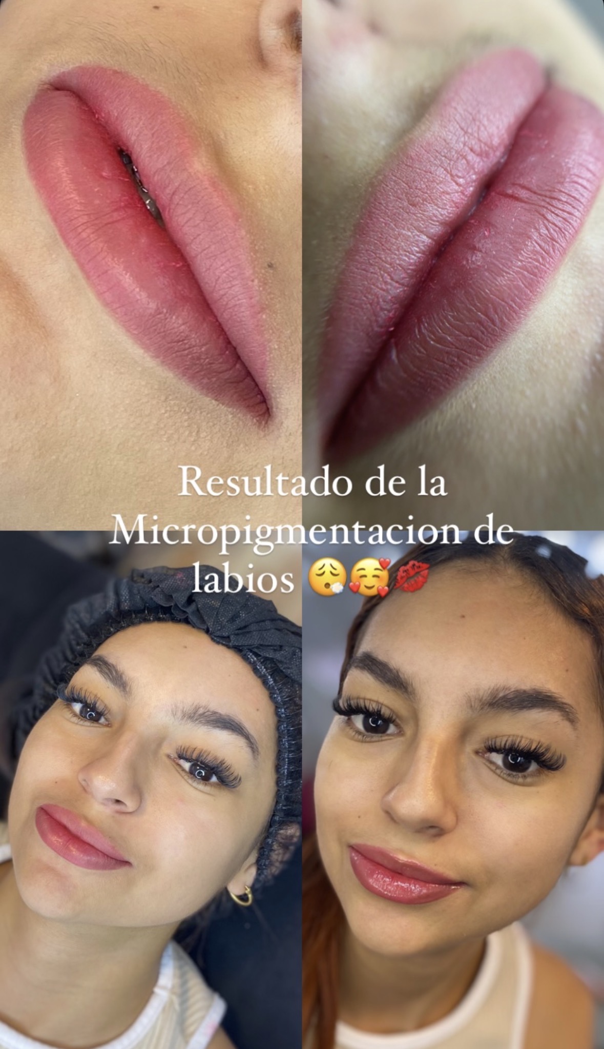 Foto del servicio Micropigmentacion de labios