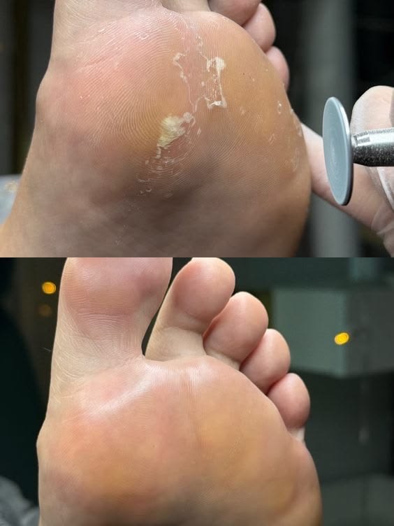 Foto del servicio Pedicure tradicional