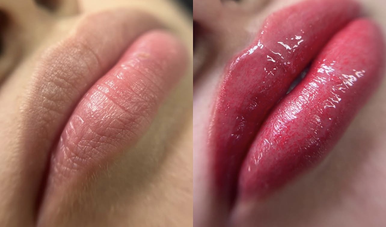 Foto del servicio Micropigmentación de Labios