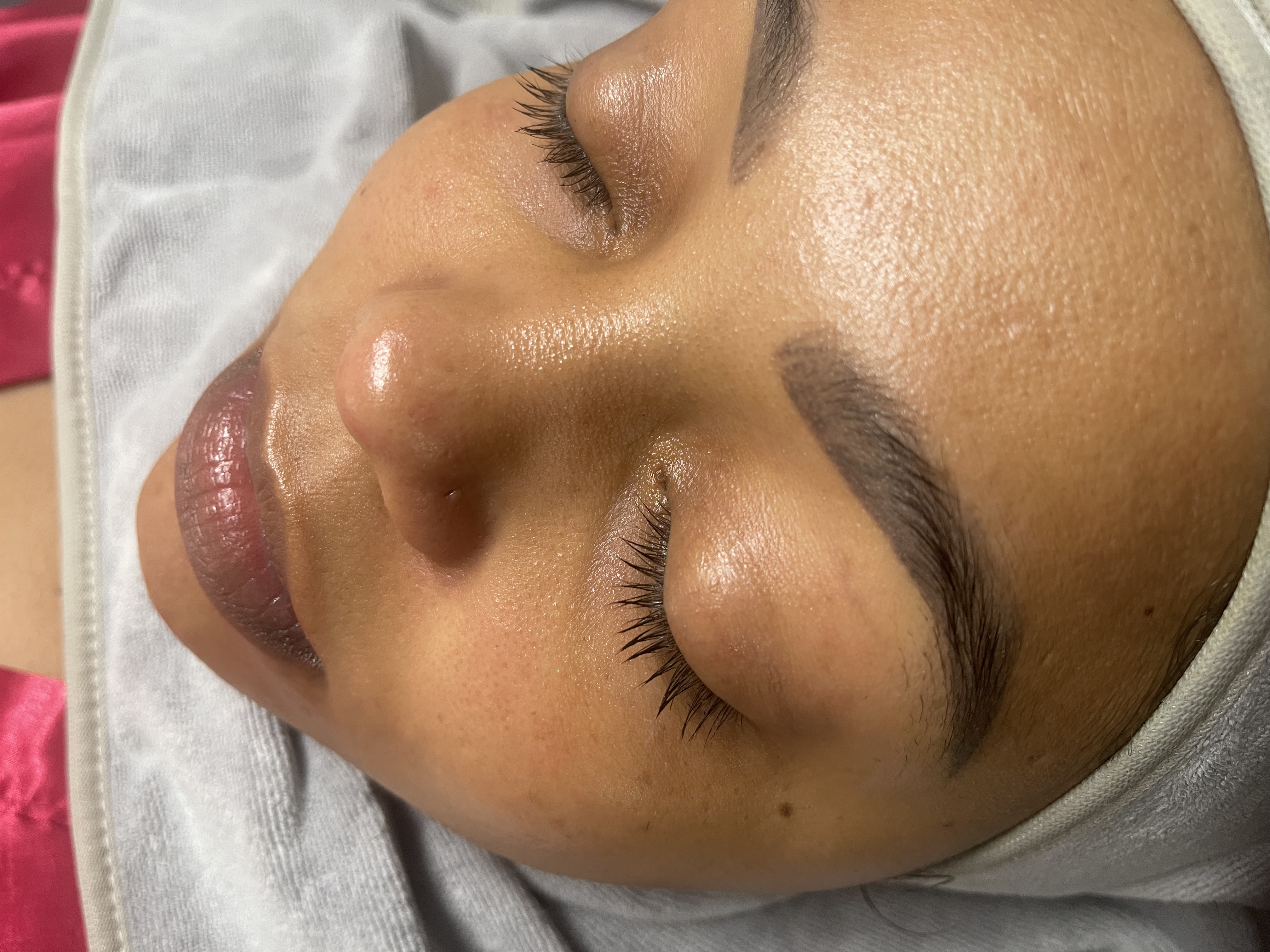 Foto del servicio Limpieza facial profunda + ácido hialuronico  y vitamina C✨