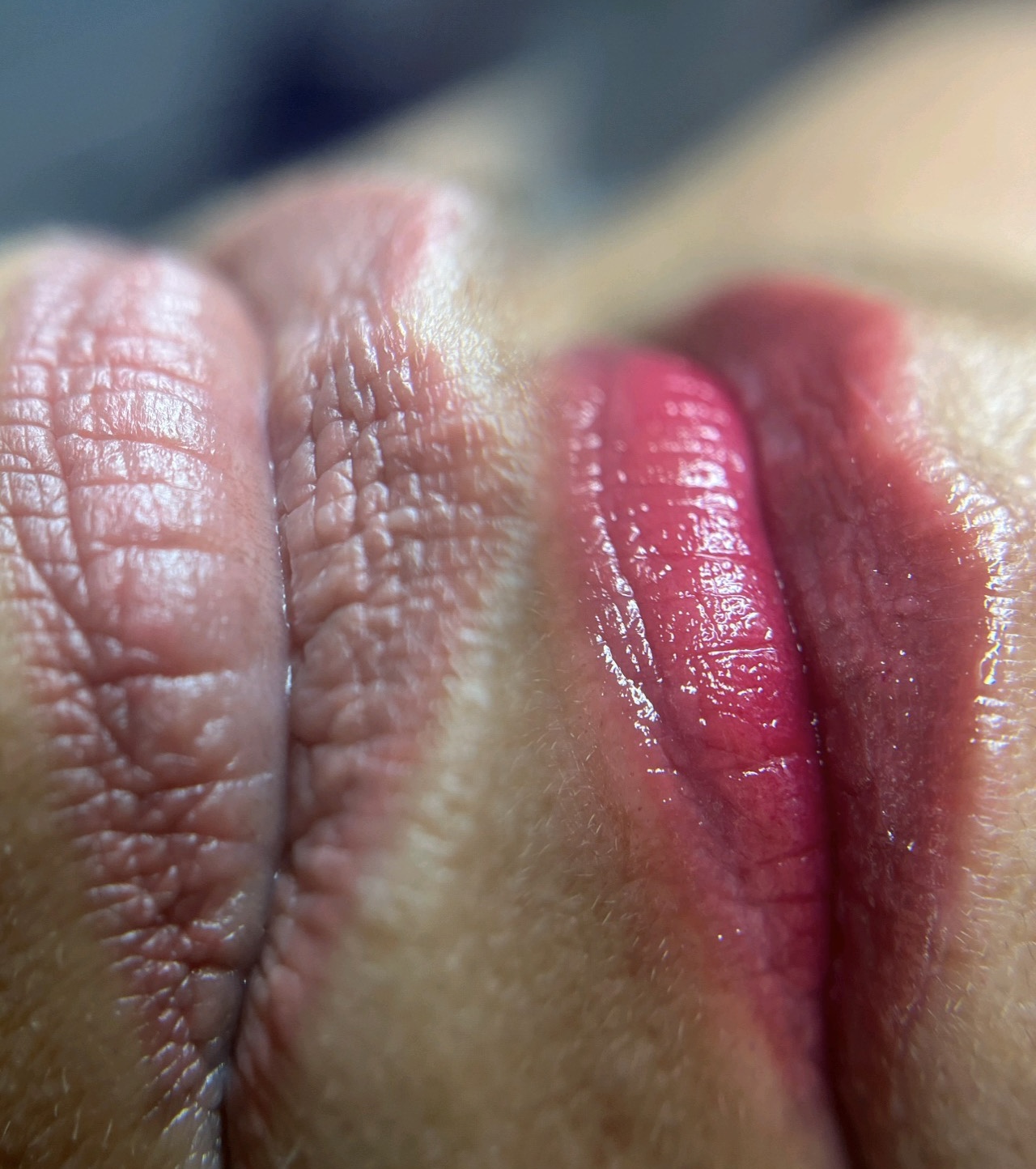 Foto del servicio HIDRATACIÓN DE LABIOS