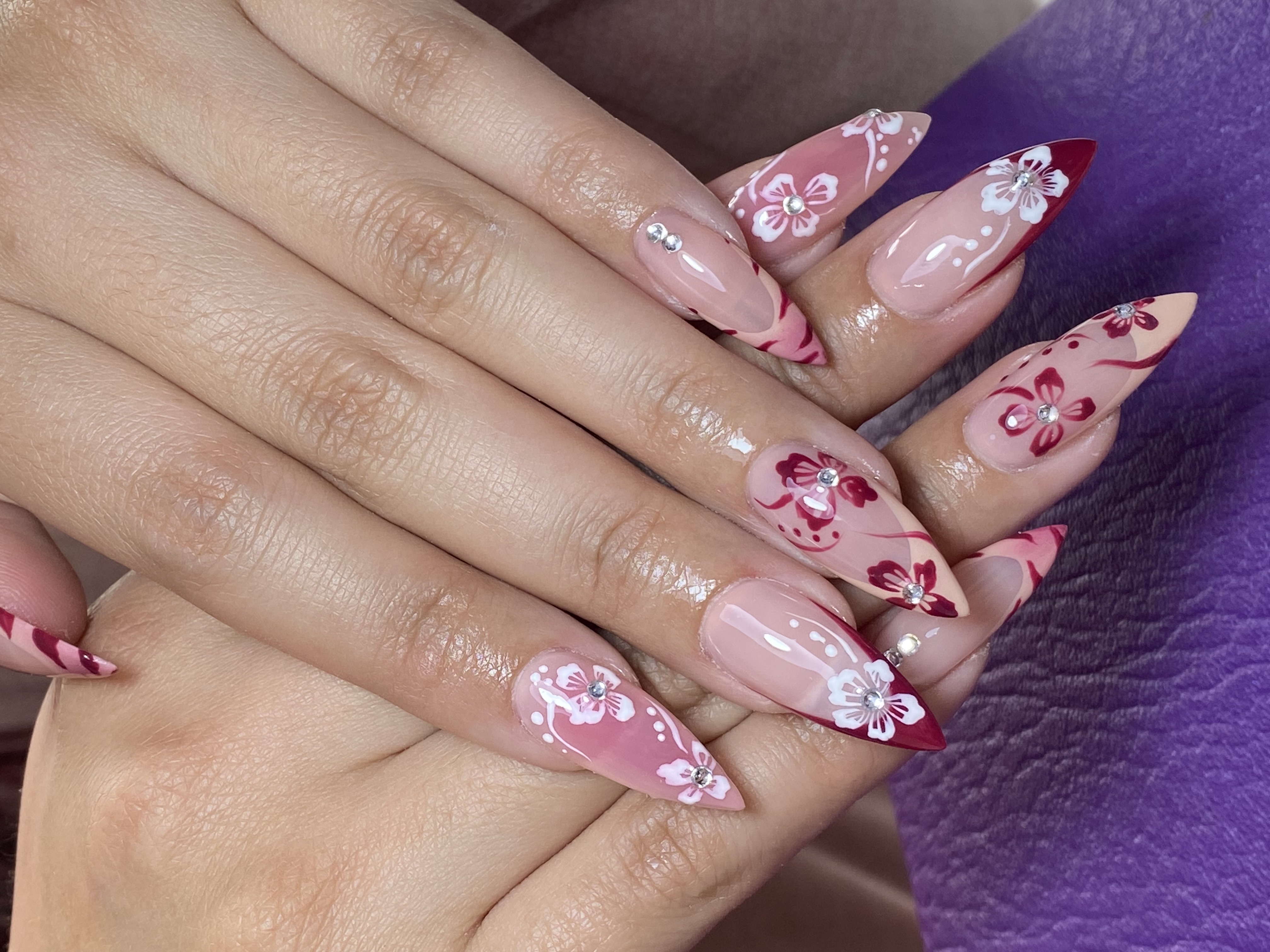 Foto del servicio Soft gel