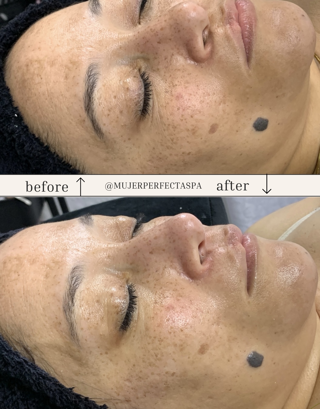 Foto del servicio Limpieza Facial ( sin extracción)
