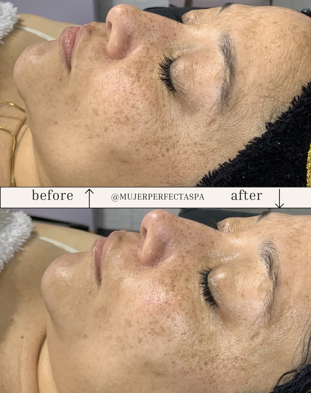 Foto del servicio Limpieza Facial ( sin extracción)