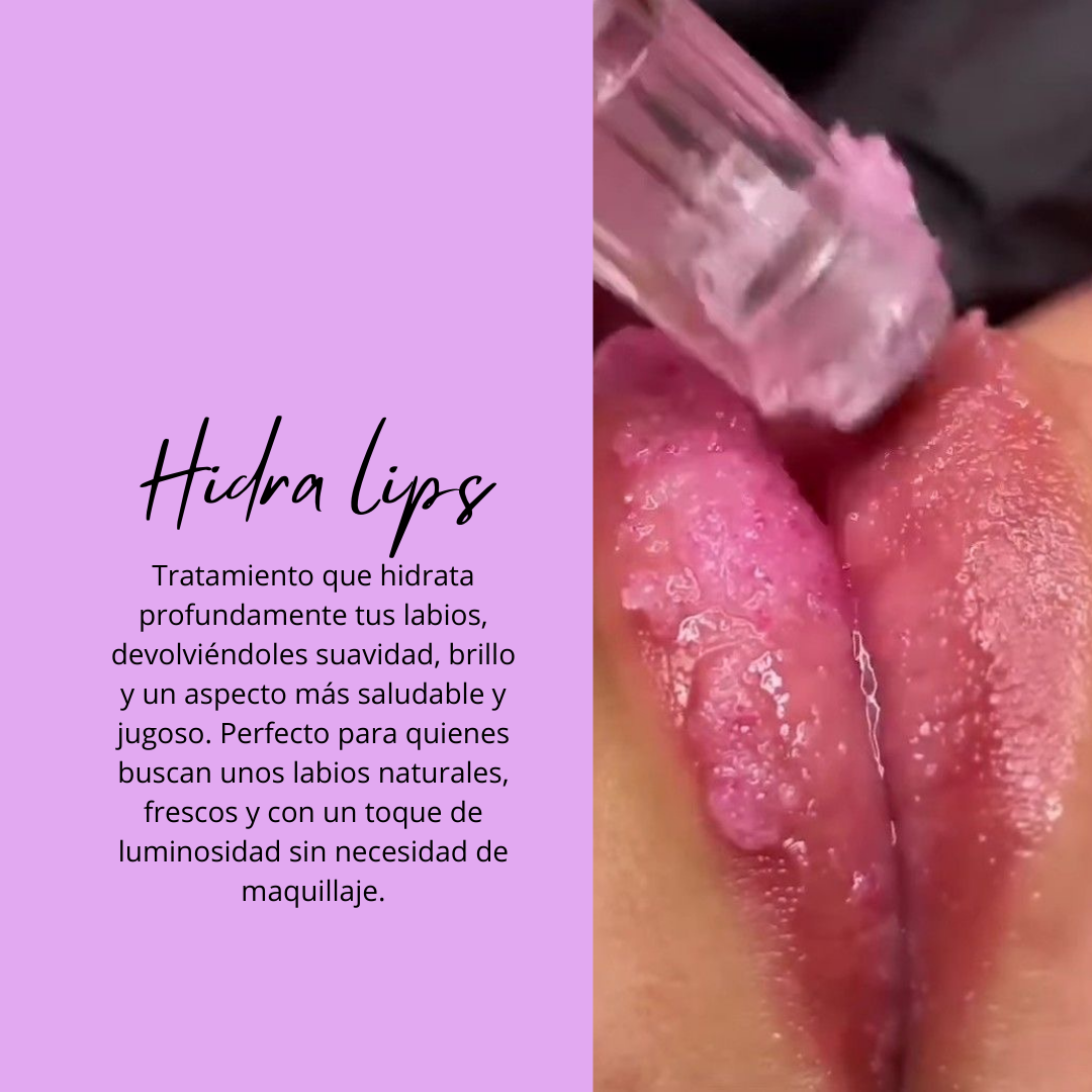 Foto del servicio Hidra lips