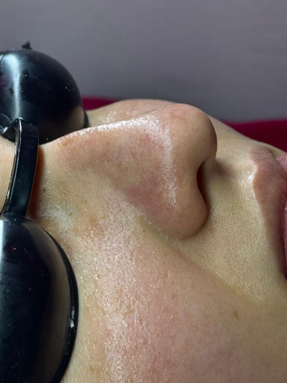 Foto del servicio Limpieza facial