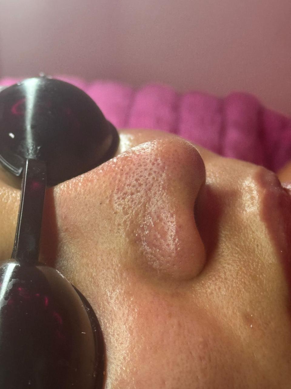 Foto del servicio Limpieza facial